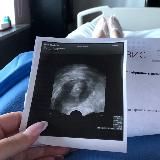 Суррогатная мама