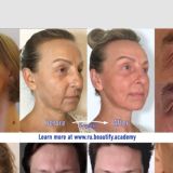 Сеплица. Школа долголетия Алексея Пинаева