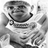 Acrolobo - Puretas sin roles modernos - Invasión electoanal