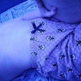 Колодец cлитых шкур