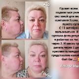 💥РЕЗУЛЬТАТЫ ПО ЛИФТИНГ-СИСТЕМЕ "SHARM"💥