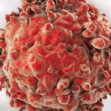 Онкология в деталях