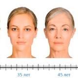 Похудение🌸Молодость🌸Здоровье