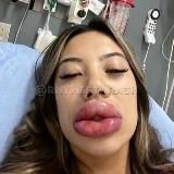 Кринжовые Анкеты