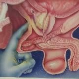 Маслович Leaky gut