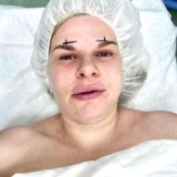 Ортогнатический дневник Ne_gorbacheva