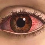 Соляная кислота