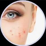 Доктор Карельский против акне