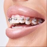 SMILE GALLERY | ЭСТЕТИКО-ФУНКЦИОНАЛЬНАЯ СТОМАТОЛОГИЯ | НОВОСИБИРСК