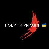 Новини України 🇺🇦 Війна