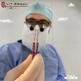 Спросите Уролога