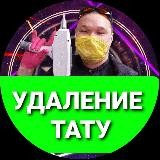 Лазерное удаление тату и татуaжа Чебоксары / Москва🎯
