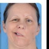 🦠❌Corona_Impfschaden_Nebenwirkungen🦠❌