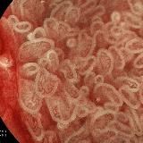 Endolife_by_dr.Golubeva