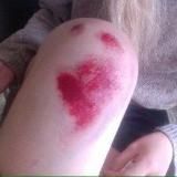 колени вдребезги