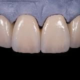 Клуб Зубной техник