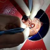 Блог кардиохирурга