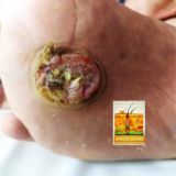 Дерматология, обсуждение