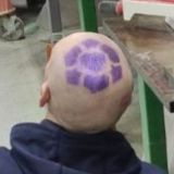 МемЦК