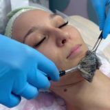 ШУГАРИНГ ЭПИЛЯЦИЯ КОСМЕТОЛОГ УЛЬЯНОВСК