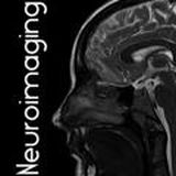 Neuroimaging