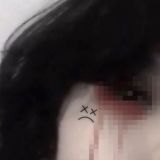 Порезы, анорексия, селфхарм