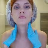 🔸🔸🔸Косметолог Карвовская🔸🔸🔸